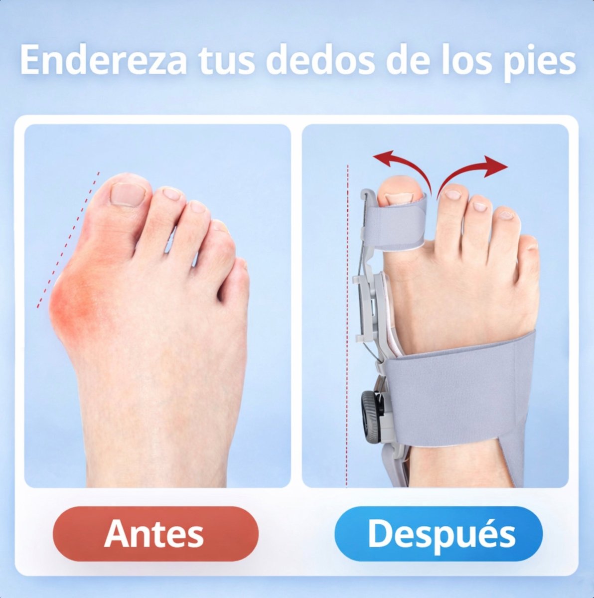 Corrector de Juanetes Ajustable Nocturno 🌙 - Rukal
